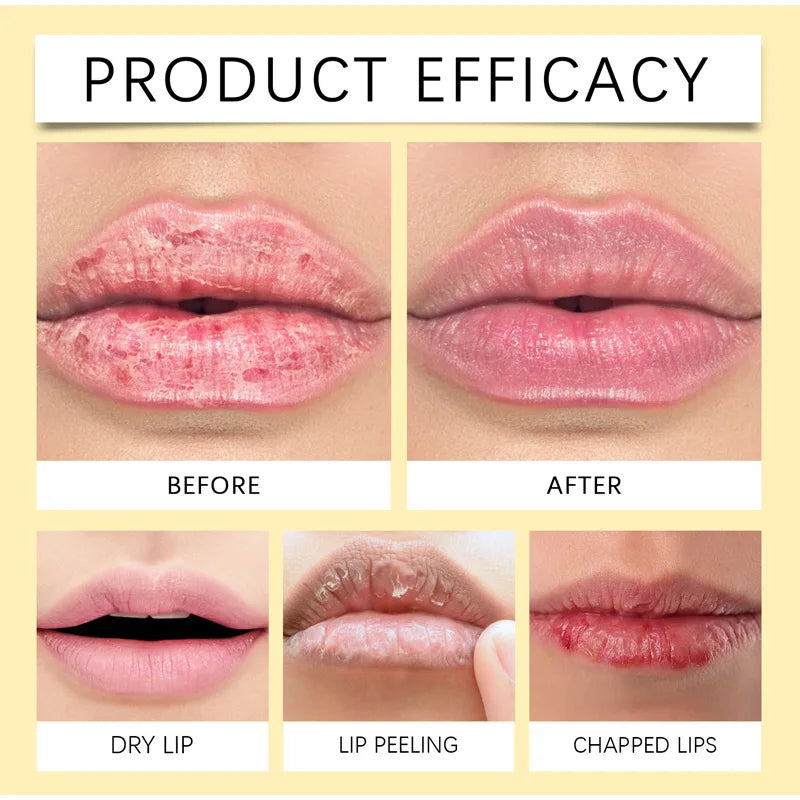 Remove Dark Lip Balm Lightening Melanin Mask Gloss Oil Exfoliating Clean Moisturizer Korean Care Products Makeup Beauty Healthy