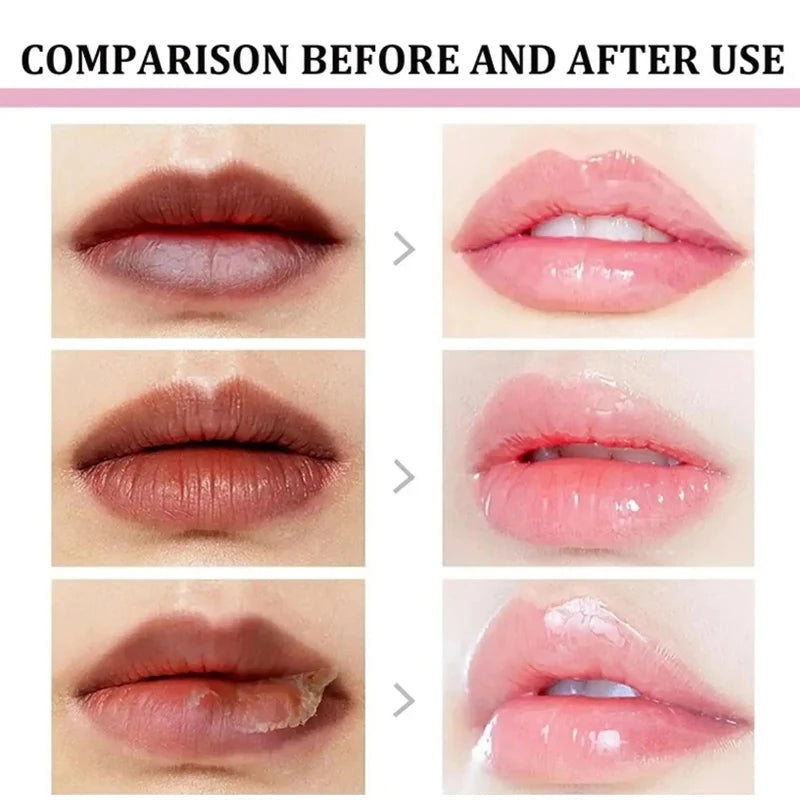 Remove Dark Lip Balm Lightening Melanin Mask Gloss Oil Exfoliating Clean Moisturizer Korean Care Products Makeup Beauty Healthy